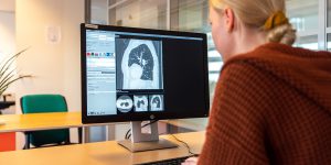 Thirona maakt met behulp van Artificial Intelligence (AI) gebruiksvriendelijke producten waarmee medische beelden geanalyseerd kunnen worden, zoals röntgenfoto’s en CT-scans. 